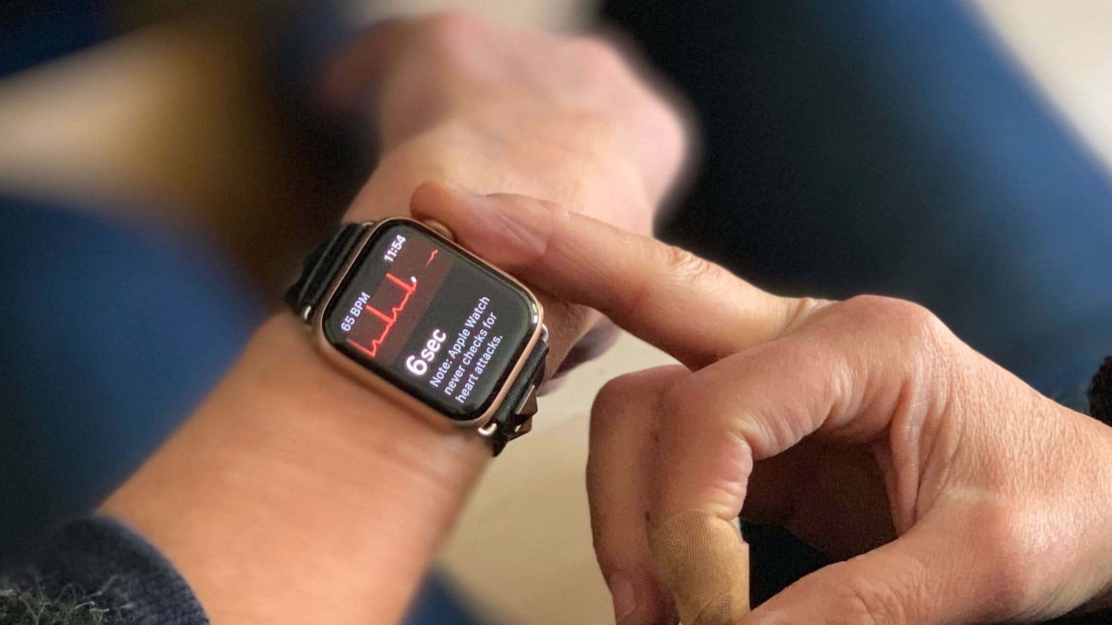 Функция получения ЭКГ в часах Apple Watch спасла человеку жизнь спустя несколько часов после выхода