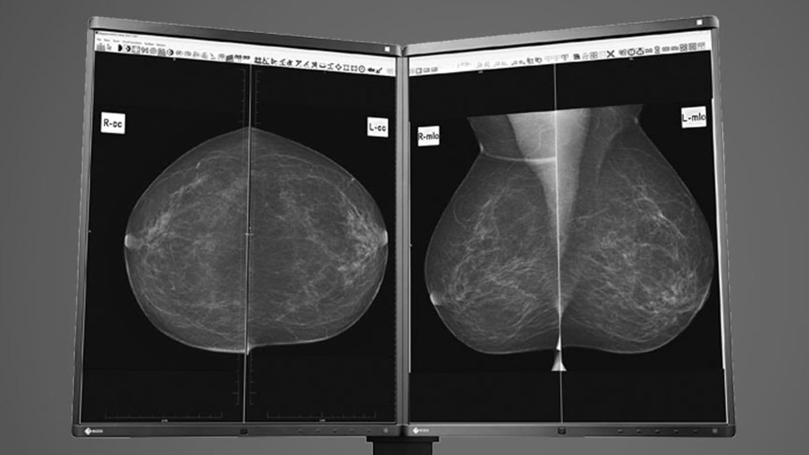 В медицинском мониторе EIZO RadiForce GX560-MD используется монохромная матрица IPS разрешением 5 Мп В медицинском мониторе EIZO RadiForce GX560-MD используется монохромная матрица IPS разрешением 5 Мп