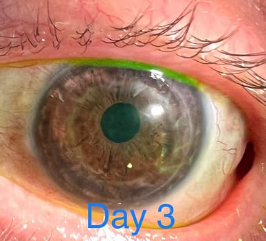 Офтальмолог уже использует макро-режим iPhone 13 Pro в своей работе