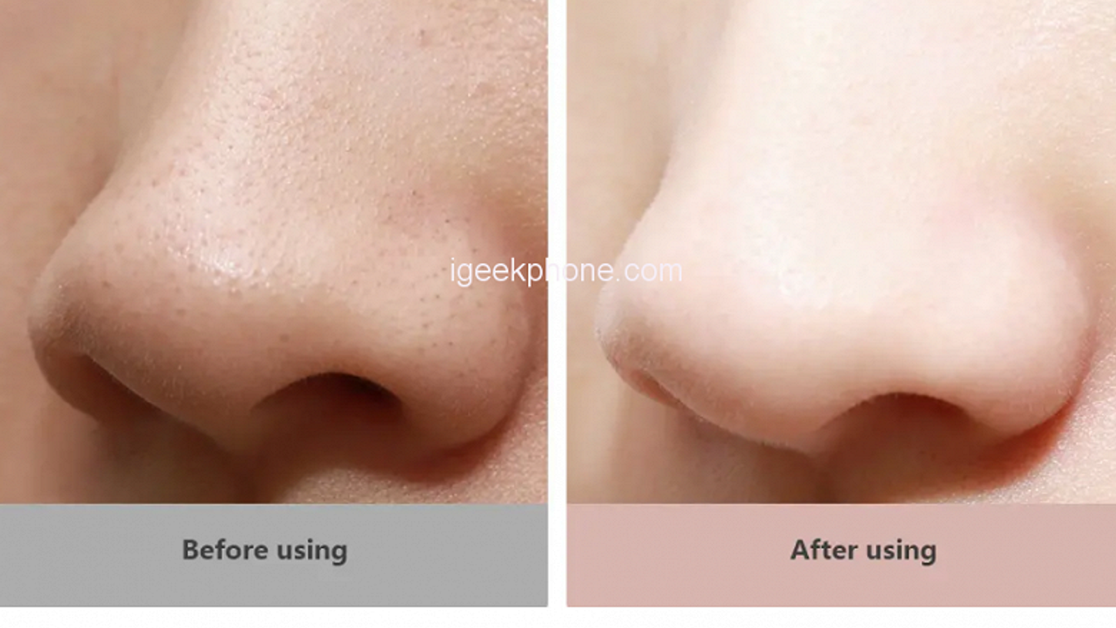 Xiaomi за $26 решила главную проблему молодежи