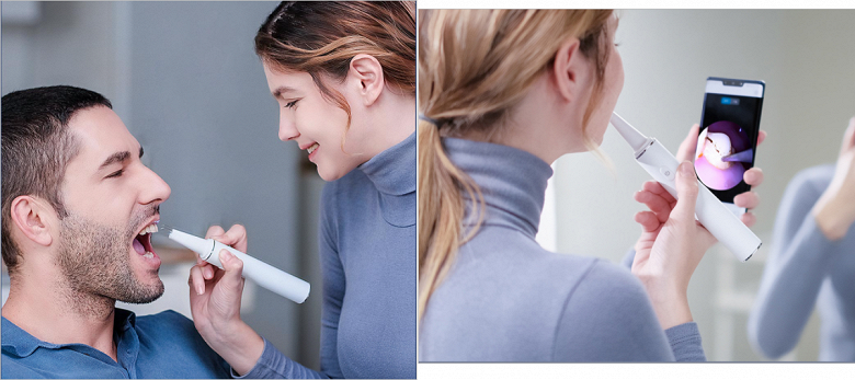 Xiaomi может оставить стоматологов без работы. Представлен ультразвуковой скалер Sunuo T11 Pro