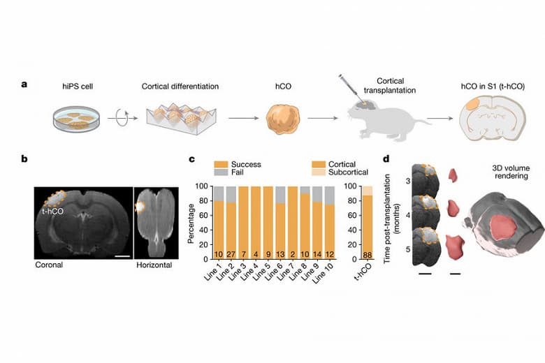 Учёным удалось вживить модель человеческого мозга в голову крысы