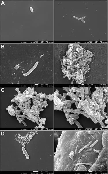 Забытый препарат из 1950-х годов полностью излечил мышей от туберкулеза за 30 дней Забытый препарат из 1950-х годов полностью излечил мышей от туберкулеза за 30 дней