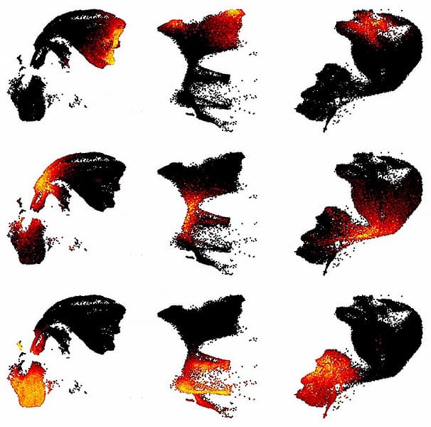 Представлена наиболее детальная молекулярная карта коры головного мозга человека Представлена наиболее детальная молекулярная карта коры головного мозга человека